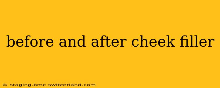 before and after cheek filler