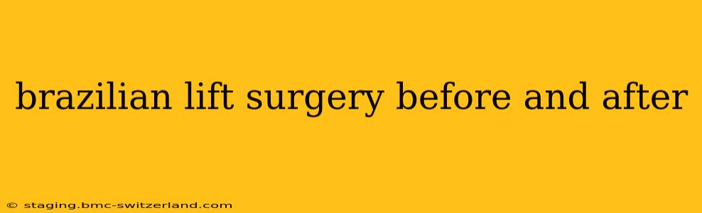 brazilian lift surgery before and after