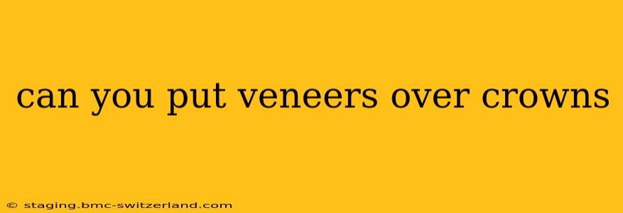 can you put veneers over crowns