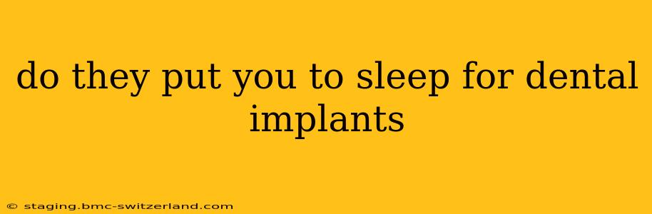 do they put you to sleep for dental implants