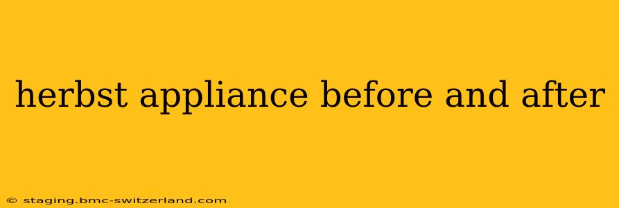 herbst appliance before and after