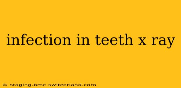 infection in teeth x ray