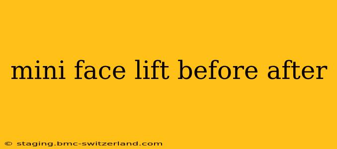 mini face lift before after