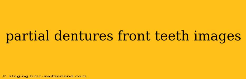 partial dentures front teeth images