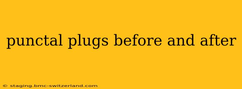 punctal plugs before and after