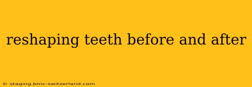 reshaping teeth before and after