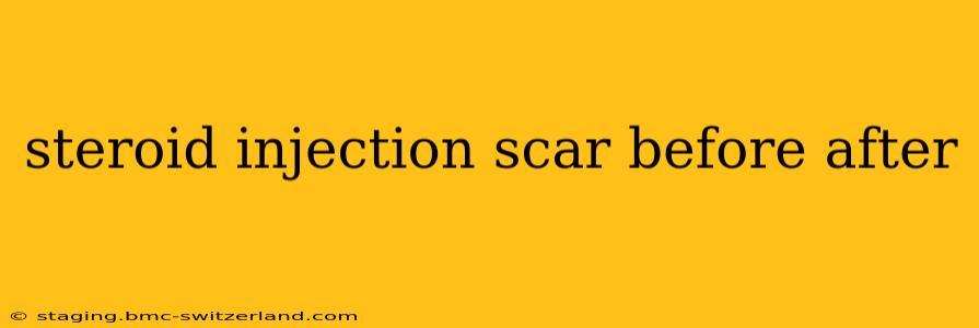 steroid injection scar before after