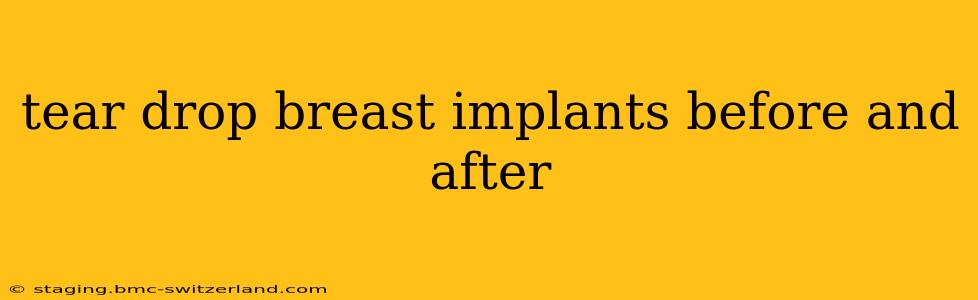 tear drop breast implants before and after
