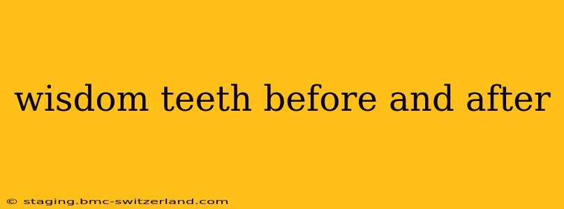 wisdom teeth before and after